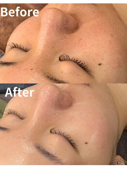 スリリアン 銀座/★お客さまビフォーアフター★