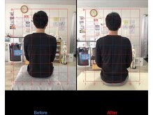 ストレチックス 近江八幡店/BeforeAfter