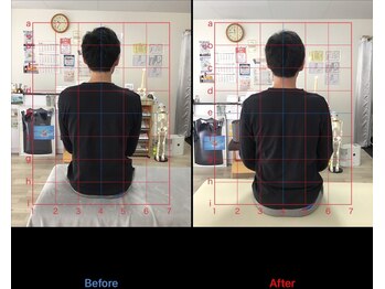 ストレチックス 近江八幡店/BeforeAfter