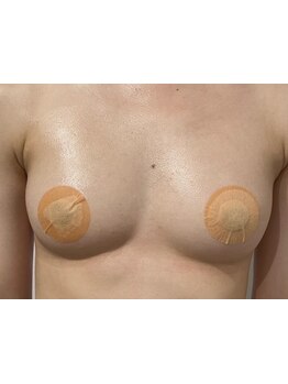 バストラインを整えたい