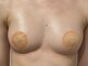レミュ(Remu)の写真/【切らないバストアップ☆】垂れ改善・ハリのある美乳に！憧れのふっくら上向きBODYに♪