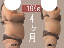 モア 星ヶ丘店(MORE)/お客様ビフォーアフター