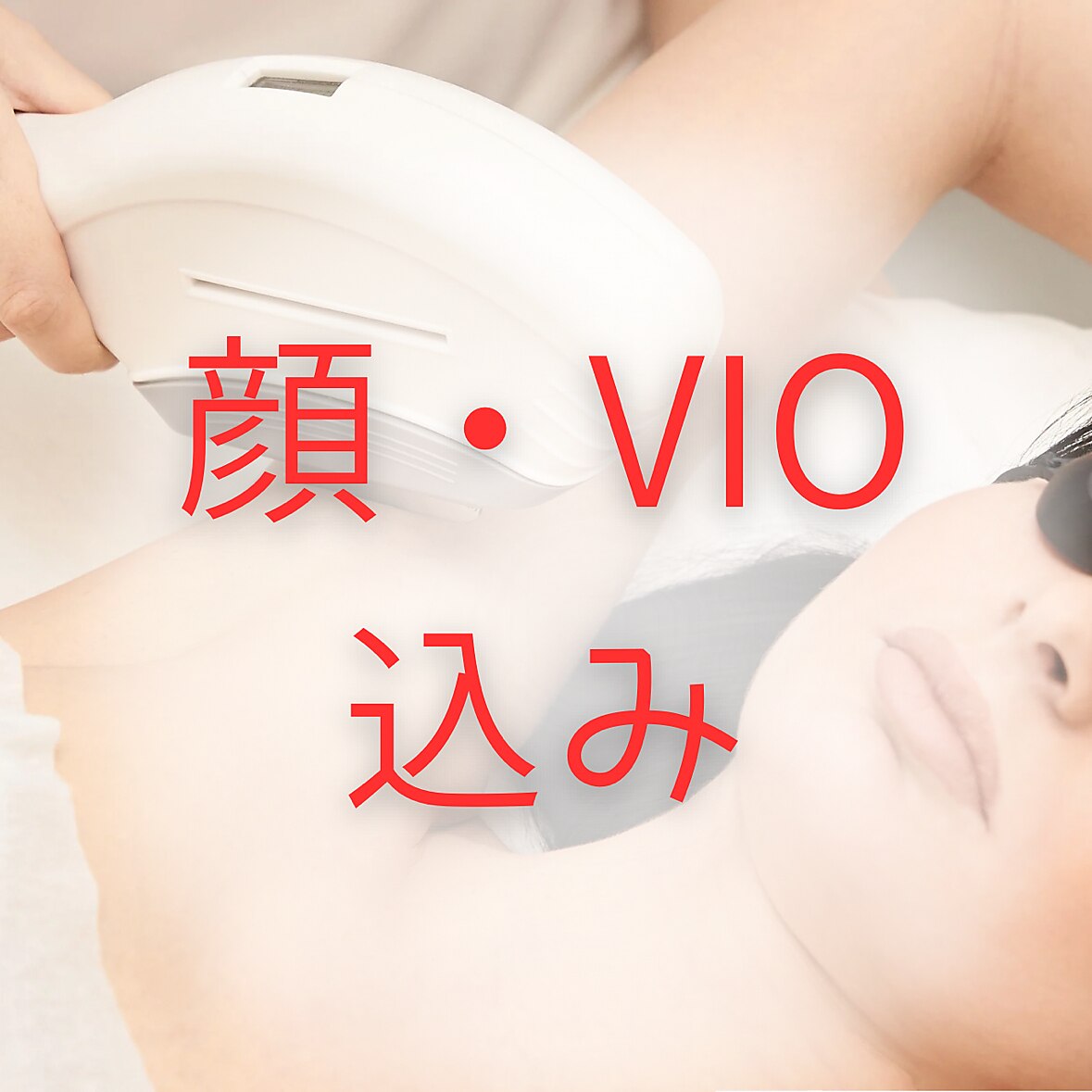 【レディース脱毛】《全身ツルスベ肌へ》（顔・VIO込み）1回\15,000☆