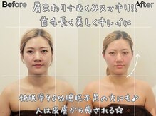 リストアハート(Restore Heart)