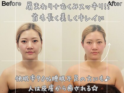 リストアハート(Restore Heart)の写真