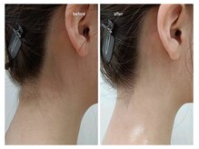 ノト(NOTO)の雰囲気(女性理容師が整える、うなじシェービング!そして、うなじ脱毛★)