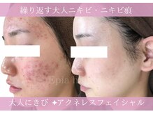 エピア 半田店(Epia)