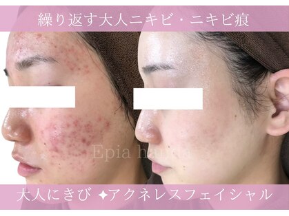 エピア 半田店(Epia)の写真