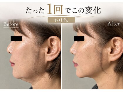 ルリエ(Relier)の写真