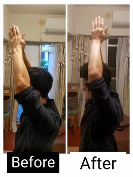 アース エンジェル整体院/ビフォアフ　肩&ストレッチ