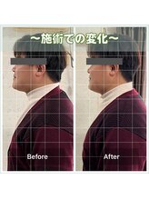 カルラ(KARURA)/頭痛や肩こりはスマホ首が原因！