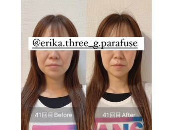 スリージー/before/after