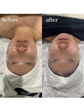 テンディ(TenD.)/レストセルトリートメント