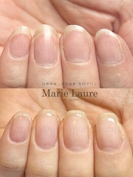 マリーロール 梅田店(Marie Laure)/深爪矯正/自爪育成/自爪風