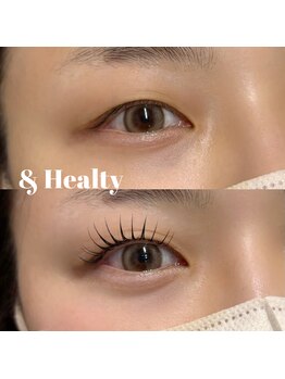 シピーアイラ(Chipieee iLa)/& Healty