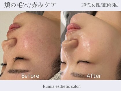 ルミア 目白 池袋(Rumia)の写真
