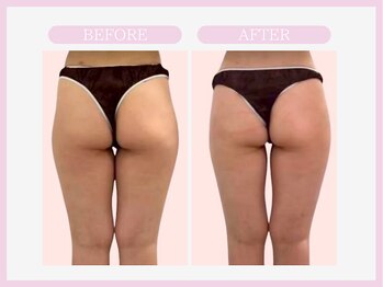 スリムライン 青森店(The Slim Line)/before→after