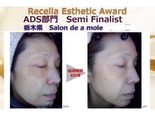 サロンドアモール(Salon de a mole)の雰囲気（本気の肌改善！なりたいお肌へ導きます！）