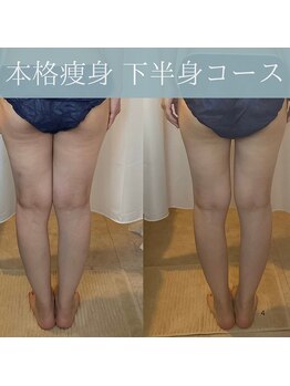 レイアス(Ray as)/ヒップの高さも変わる♪