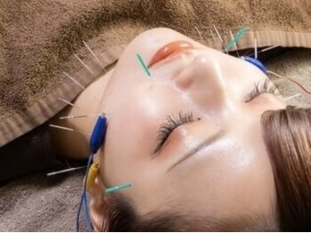 鍼灸ハリカラの写真/【小顔・リフトアップ・肌質改善に◎】美容鍼で本来のハリと輝きを取り戻す！