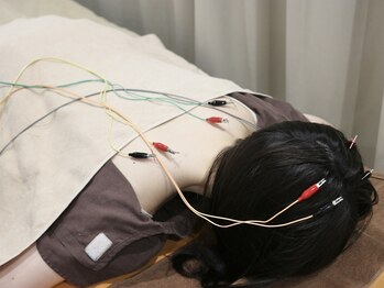 みのり鍼灸整骨院【肩こり/腰痛/小顔美容鍼/眼精疲労/自律神経/整体/睡眠/肩甲骨】の写真/「どこへ行っても酷い首肩の痛みが戻る…」長引くガチガチ慢性痛、自律神経から根本改善!