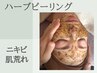 【ニキビ肌荒れ改善】剥離なし◎9種の和漢配合ハーブピーリング