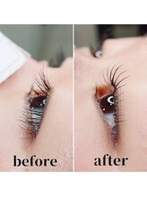 ルイエ(L’oeillet)/コスメティックラッシュリフト