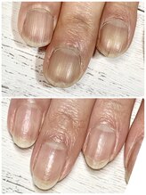 ユキネイル(YUKINAIL)/ここまでかわる！？！？