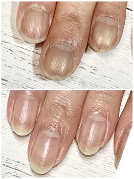 ユキネイル(YUKINAIL)/ここまでかわる!?!?