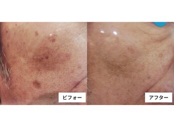 エムズ(M’s)/かなり目立たなくなりました。