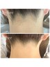男女OK！清潔感UP☆うなじ脱毛￥5,500→￥3,500　【豊橋/うなじ脱毛/エステ】