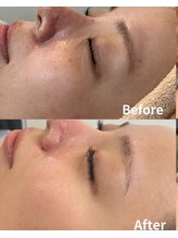 スリリアン 銀座/★お客さまビフォーアフター★