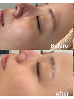 スリリアン 銀座/★お客さまビフォーアフター★