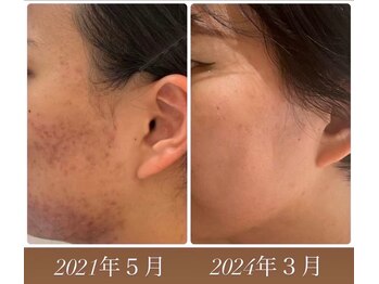 ハリーベージュ(Hariy Beige)/HariyBeige麻布十番