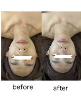 アヴァンサル 札幌駅前店(Avanzar)/完全都度払いフェイシャル