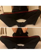 イリス 神田(iris)/股関節のトラブル