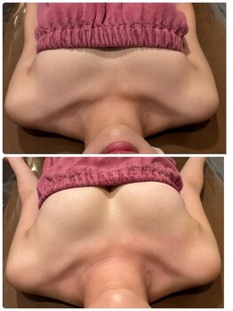 ロココ 豊田店(Rococo)/ビフォーアフター