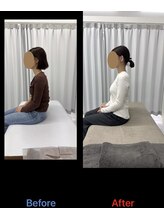 整体リアン 天神院(Lien)/ビフォーアフター：座位姿勢