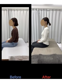 整体リアン 天神院(Lien)/ビフォーアフター:座位姿勢