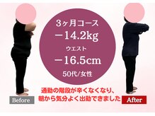 南桜井あおば鍼灸整骨院 春日部/ダイエット実績50代