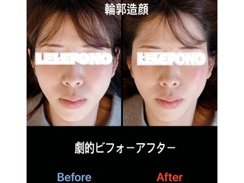 美容矯正サロン レレポノ(LELEPONO)/