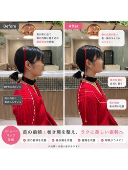 ふみらぼ 亀有/亀有で巻き肩・猫背を整える