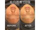 ティーグレ 赤坂(Tigre)の写真