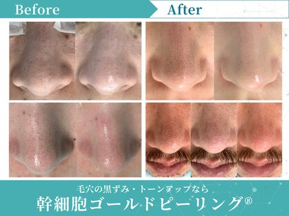 リメイク 広尾(REMAKE)の写真