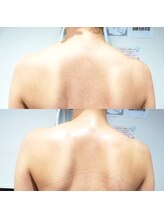 RiとBiのたまご/（ブライダル）引締め