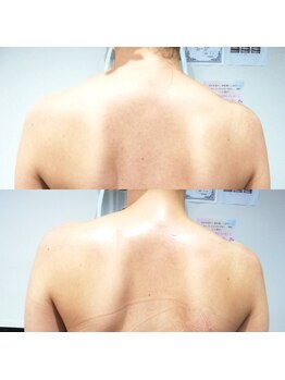 RiとBiのたまご/（ブライダル）引締め