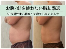 ソルニス(Solnis.)/痩身☆脂肪分解/ハイパーナイフ