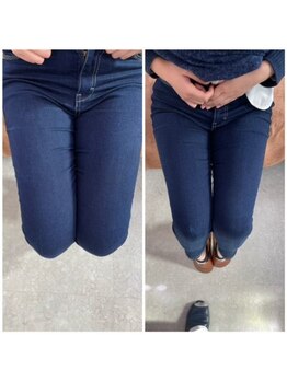 はるかぜ療術院/太もものセル脂肪！下半身やせ