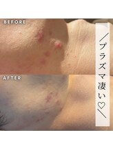 オリオンドットエスツー(Orion.S2)/【Before→After】