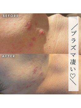 オリオンドットエスツー(Orion.S2)/【Before→After】